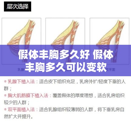 假体丰胸多久好 假体丰胸多久可以变软