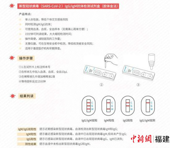 新冠病毒抗体igm是什么 新冠病毒抗体igm是什么检查