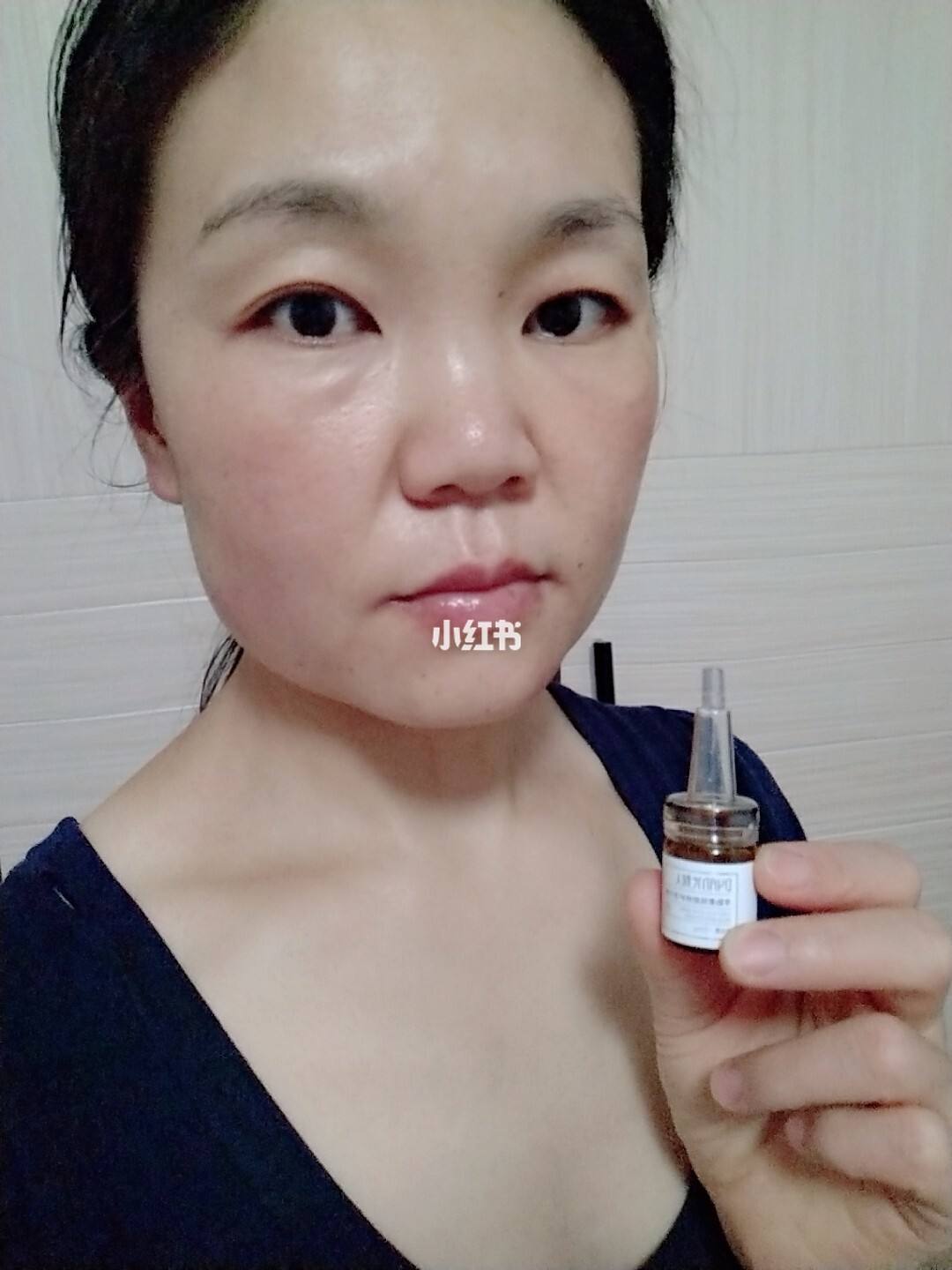 冻干粉还要抹水和霜吗 冻干粉用了要洗脸再擦水吗