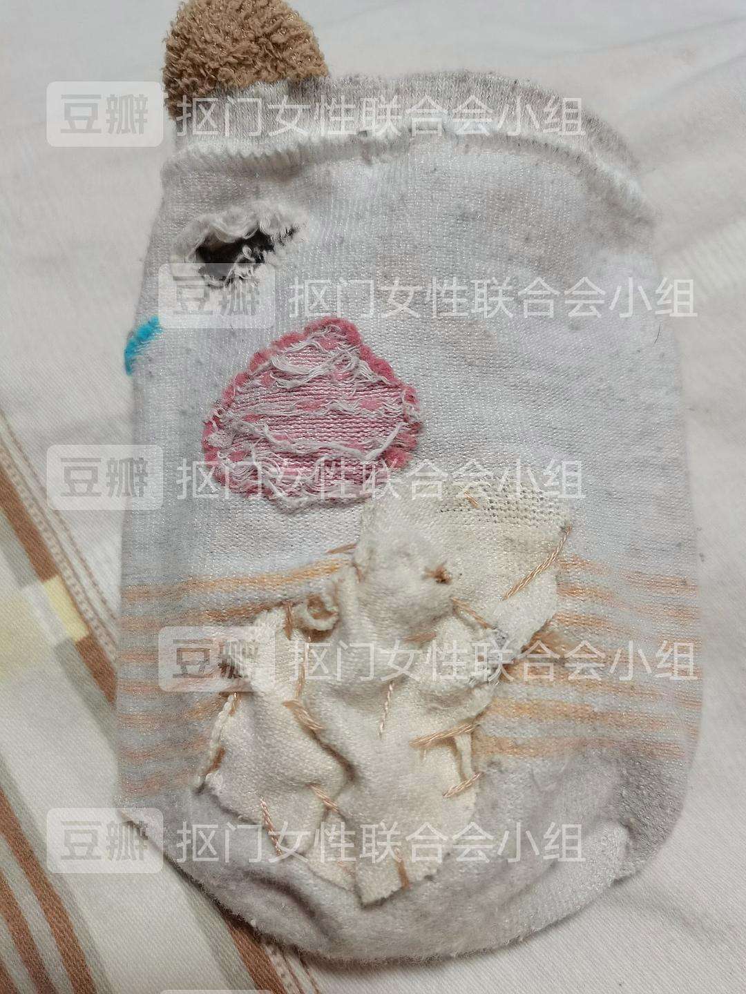 压缩毛巾有洞怎么补 压缩毛巾有洞怎么补救视频