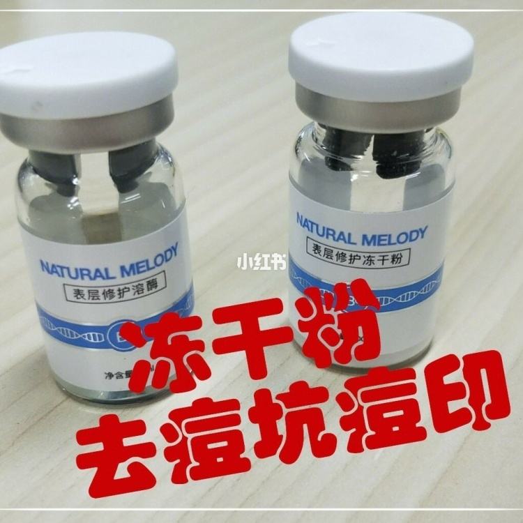 眼睛红肿能不能用冻干粉 眼睛红肿可以用冰块敷吗?