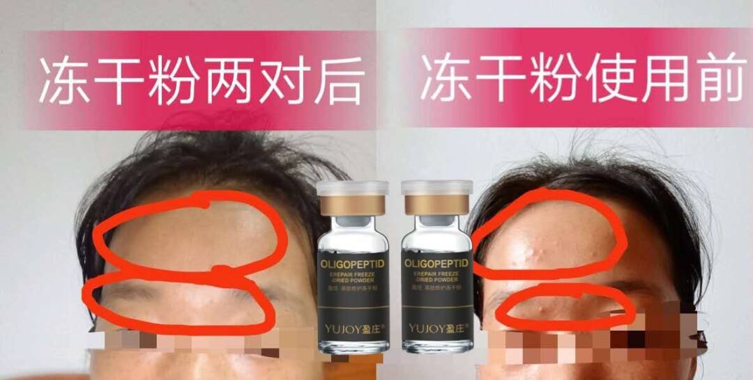 眼睛红肿能不能用冻干粉 眼睛红肿可以用冰块敷吗?